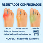 Juanete corrector ortopedico ajustable