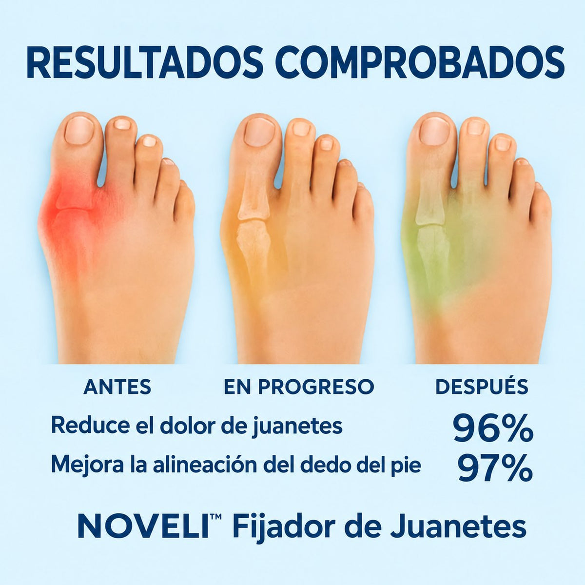 Juanete corrector ortopedico ajustable